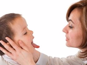 Nguyên nhân gây nhiệt lưỡi ở trẻ là do đâu?
